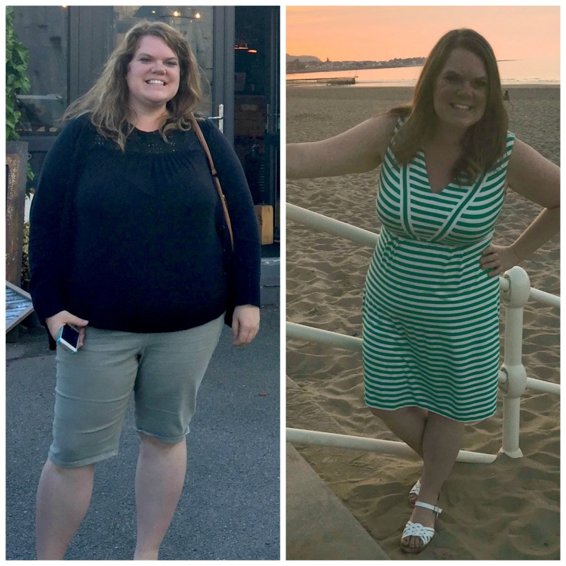 Before and After me anniversary